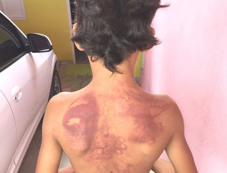 Homem é preso após agredir enteado com chineladas