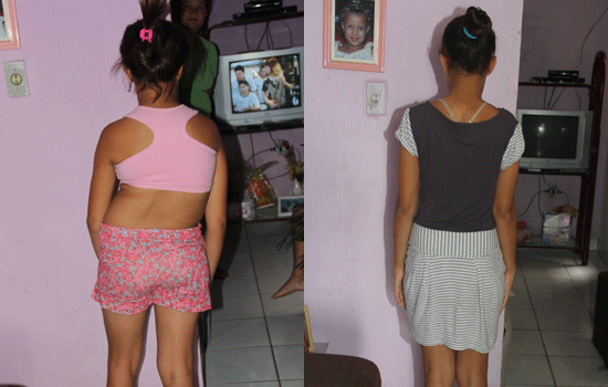 Segundo o médico, o costume de ter ficado com o corpo inclinado ainda é visível, mas se ajustará com as fisioterapias.