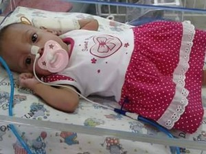 ES – Jovem cai de escada e, no hospital, descobre gravidez 2h antes do parto