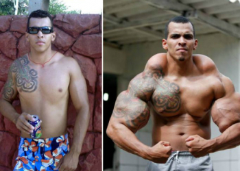 GO – Fisiculturista que queria virar ‘Incrível Hulk’ quase teve braços amputados