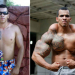 GO – Fisiculturista que queria virar ‘Incrível Hulk’ quase teve braços amputados