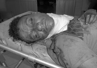 Ambulância é interceptada e criminosos tentam matar homem pela segunda vez, cortando a sua garganta