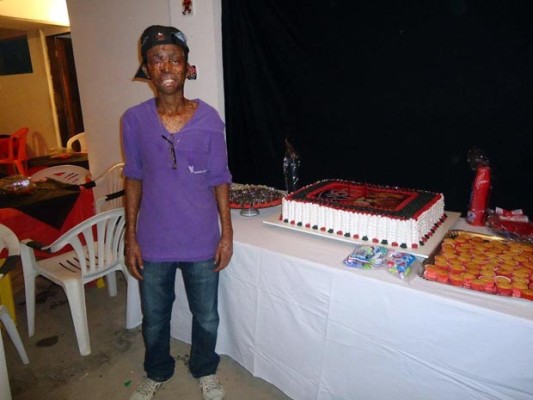 Jovem de 21 anos já fez 130 cirurgias por causa de doença 