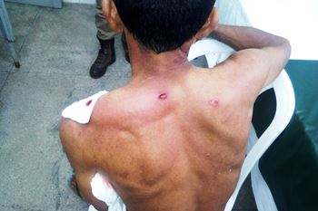 Pedreiro leva tiro durante tentativa de assalto em Povoado de São Domingos