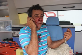 Motorista fica ferido depois de bater em poste e descer ribanceira