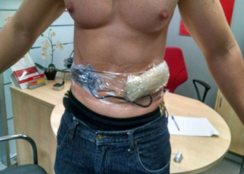 Tesoureiro de banco tem explosivos presos ao corpo por assaltantes; Bope tenta desativar bomba