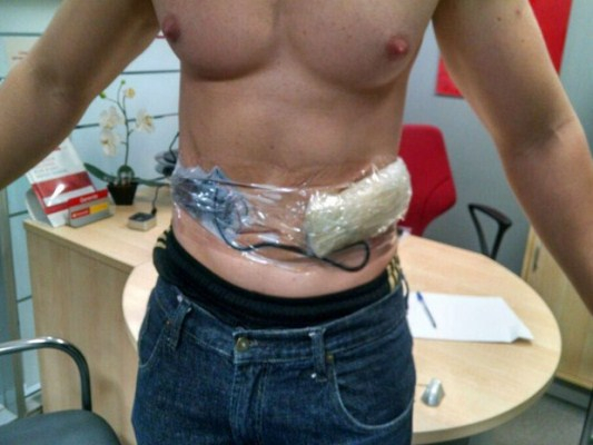 Tesoureiro de banco tem explosivos presos ao corpo por assaltantes; Bope tenta desativar bomba