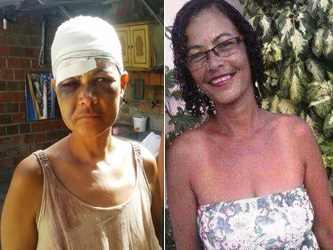 Nide antes e depois de sofrer as agressões | Foto arquivo da família