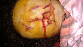 Coité – Familiares de mulher espancada e estuprada pedem a prisão de criminoso que está foragido