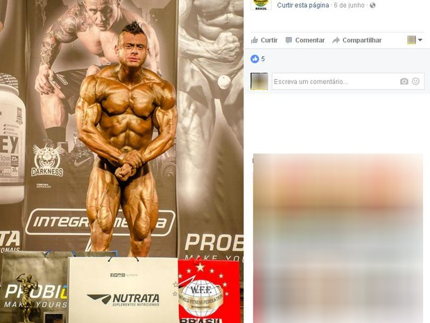 Jovem morre por suspeita de uso excessivo de anabolizante, diz médico