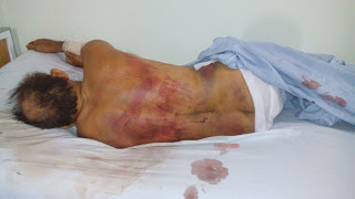 Idoso é espancado após ser flagrado fazendo sexo com mula em Quijingue