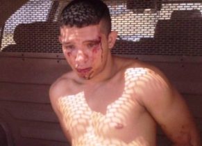 Suspeito de roubo é assaltado e agredido durante a fuga e reclama da violência em delegacia (Foto: Sobral 24 horas) 