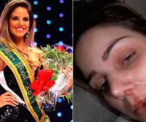 Miss sofre agressão de ex-marido e denuncia crime na web; confira vídeo