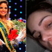 Miss sofre agressão de ex-marido e denuncia crime na web; confira vídeo