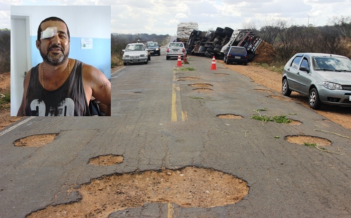 Caminhoneiro teria tentado se livra desses buracos quando acabou tombando | Foto: Raimundo Mascarenhas