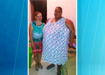 Filho pede a Papai Noel bariátrica para a mãe, mas mulher morre com 245 kg