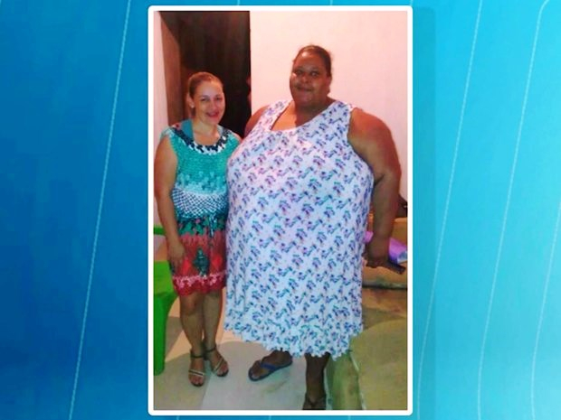 Filho pede a Papai Noel bariátrica para a mãe, mas mulher morre com 245 kg