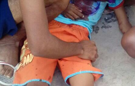 Garoto de 12 anos atinge outro de 9, com tiro de espingarda em Distrito de Valente; suspeita-se que disparo foi acidental