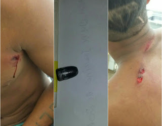 Menor é atingido com dois tiros dentro de igreja evangélica na cidade de Caém