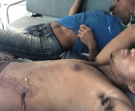 Água Fria – Durante abordagem guarda municipal atira e atinge três homens e um morre na hora