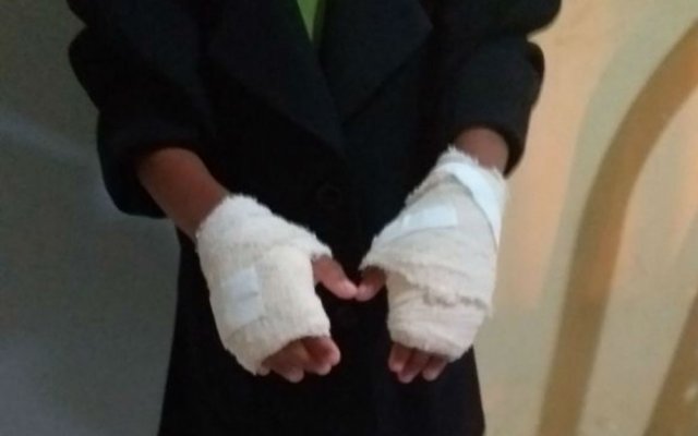 Mulher é presa por queimar mãos de criança devido a ‘mau comportamento’