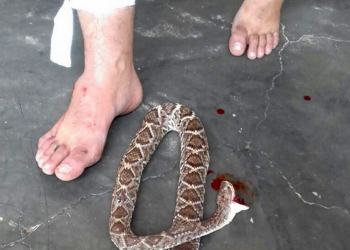 PB – Vereador é picado por cascavel e se vinga matando o réptil a mordidas