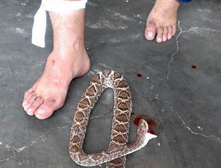 PB – Vereador é picado por cascavel e se vinga matando o réptil a mordidas