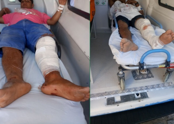 Pai e filho ficam feridos em colisão envolvendo moto e Uno na zona rural de Nordestina