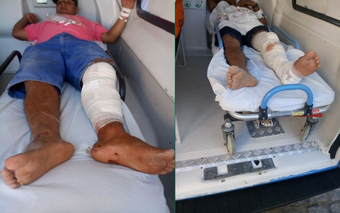 Pai e filho ficam feridos em colisão envolvendo moto e Uno na zona rural de Nordestina