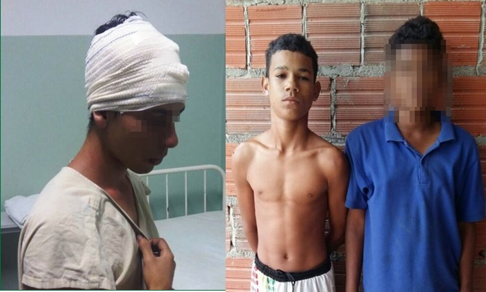 Coité I – Jovem leva tiro de raspão na cabeça ao reagir assalto