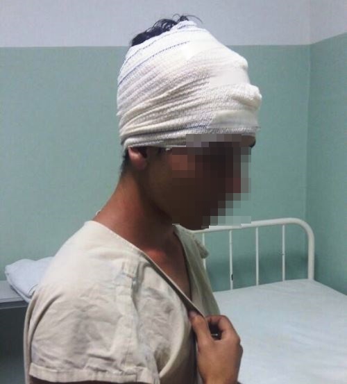 Coité I – Jovem leva tiro de raspão na cabeça ao reagir assalto