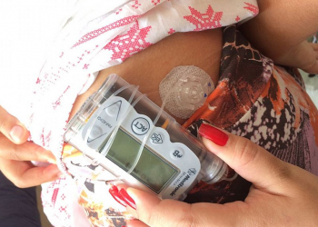 Estudante é impedida de fazer Enem por uso de bomba de insulina