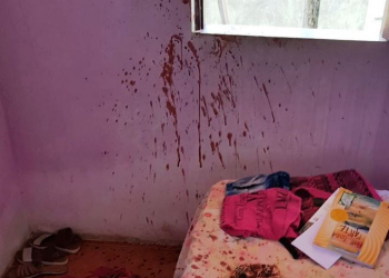 Mulher sofre tentativa de feminicidio a golpes de facão na zona rural de Coité