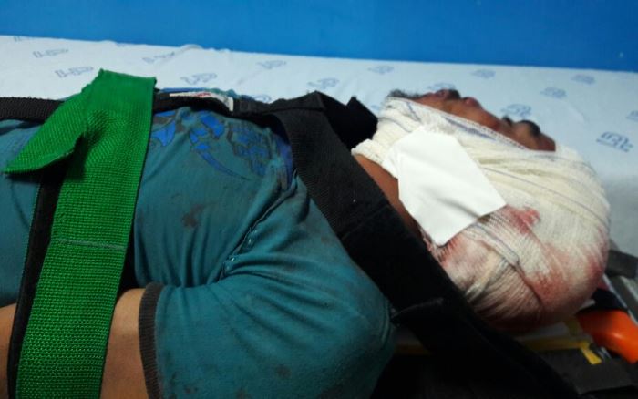 Coité – Homem sofre tentativa de homicídio a golpes de faca e paulada na cabeça