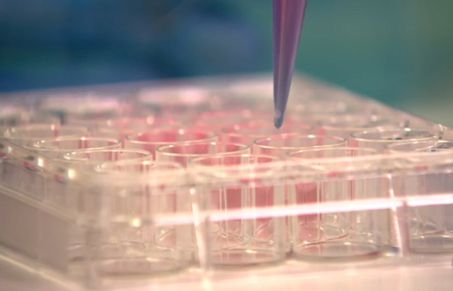 Pesquisa comprova que vírus da Zika mata células cancerígenas do cérebro