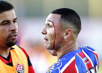 BA-VI – Vinícius registra ocorrência após agressão no clássico