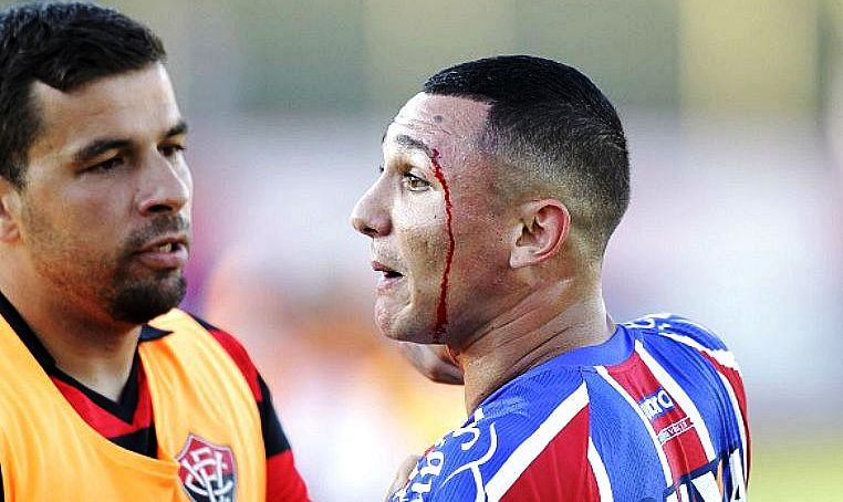 BA-VI – Vinícius registra ocorrência após agressão no clássico