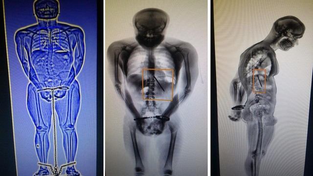 Preso engole faca e finge briga para tentar fugir da Papuda, em Brasília
