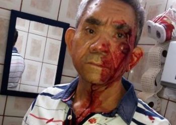 SP – Agredido a socos por aluno de 14 anos, professor diz que não quer mais dar aula