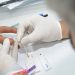 Em 2018, Feira de Santana registrou 360 novos casos de pessoas contaminadas com HIV