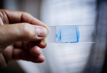 Fungo fatal que se espalha por hospitais de todo o mundo pode chegar ao Brasil