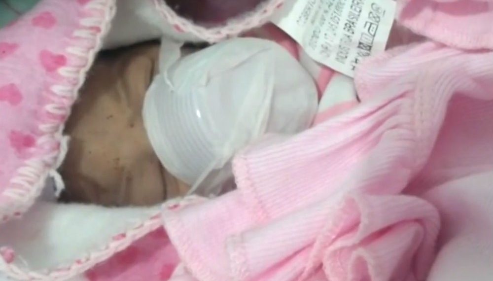 Com máscara de oxigênio suja, hospital usa copo descartável como substituto e reanima bebê