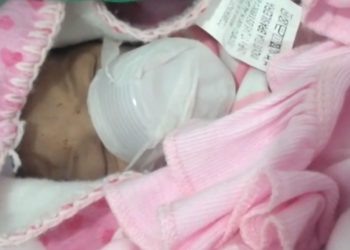 Com máscara de oxigênio suja, hospital usa copo descartável como substituto e reanima bebê