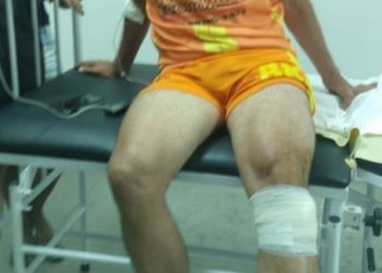 Vereador leva tiro no joelho quando retornava de partida de futebol na zona rural