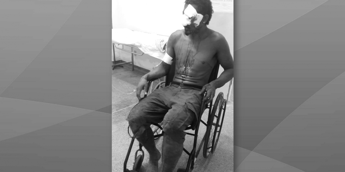 Homem morre em hospital após ser espancado em povoado