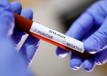 Bahia registra apenas 3 novos casos do Coronavírus nas últimas 24h