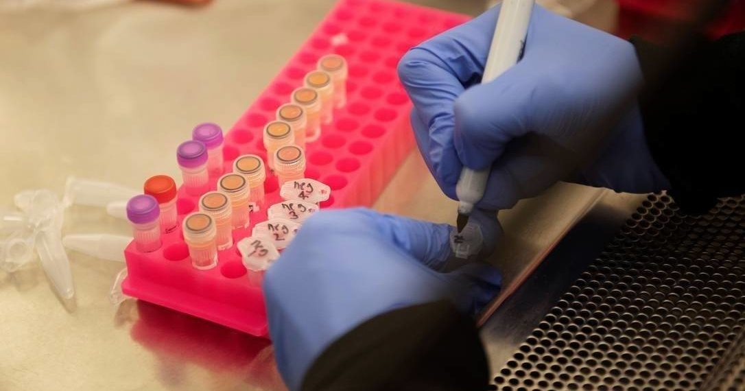 Coronavírus: Ministério vai permitir que médicos usem remédio da malária em pacientes graves