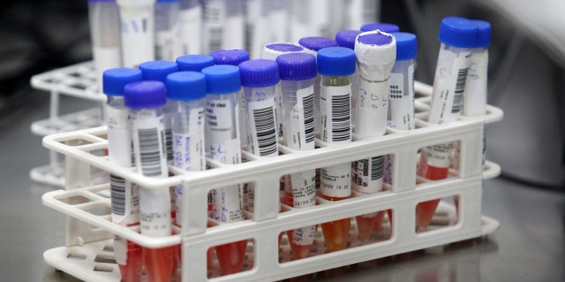 Com entrega de nova ala do Lacen, Bahia passa a ter capacidade para realizar mil testes diários da Covid-19