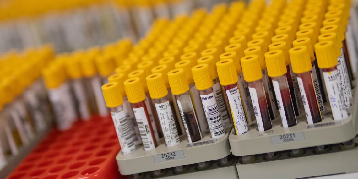 País registra 1.124 óbitos pela covid-19; são mais de 20,7 mil casos