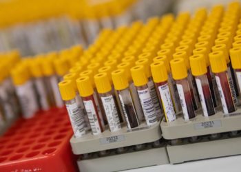 País registra 1.124 óbitos pela covid-19; são mais de 20,7 mil casos